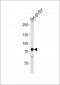 ABCD3 Antibody