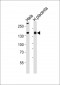 COL4A1 Antibody (N-term)