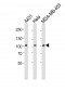 EphB1 Antibody (C-term)