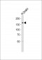 TRPM8 Antibody (Center R536)