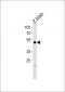 (DANRE) irf2bp2b Antibody (N-term)