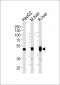 PAH Antibody (Center)