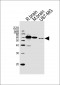 Tyrosine Hydroxylase Antibody