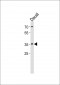 FOSL2 Antibody (Center)