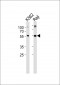 HCLS1 Antibody (C-term)