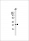 hNRG1-Q212 Antibody