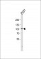 GIT2 Antibody (C-term)