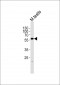 PHF1 Antibody (N-term)