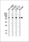 SMAD1 Antibody (Center)