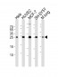 CDKN1A Antibody (C-term)