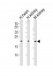 CYS1 Antibody  (C-term)