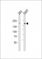 DIAPH1 Antibody (N-term)