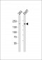 DIAPH1 Antibody (N-term)