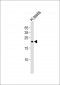 FATE1 Antibody (Center)