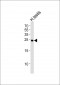 IZUMO2 Antibody (Center)