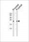 RCVRN Antibody (C-term)