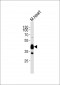 LDB3 Antibody (N-term)