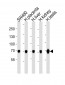 TRPV6 Antibody (Center)