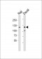 PTK2B Antibody (C-term)