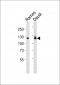 PTK2B Antibody (C-term)