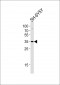 STX1B Antibody (Center)