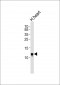 NDUFV3 Antibody (C-term)