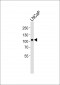 MME Antibody (N-term)