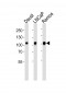MME Antibody (N-term)