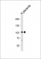 LEPRE1 Antibody (Center)