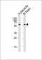 PPARG Antibody (N-term)