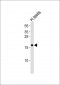 SPANXA1 Antibody (N-term)