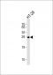 MAD2L1 Antibody (C-term)