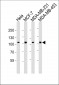 AFAP1-Y451 Antibody