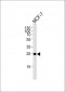CDKN1B-Y88 Antibody