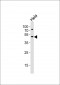 VPS4A Antibody (N-term)