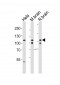OPA1(form S1) Antibody (C-term)