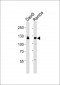 PTK2B Antibody (C-term)