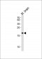 CPLX2 Antibody (Center)
