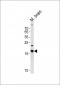 CPLX2 Antibody (Center)