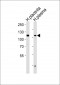 ENPP2 Antibody (Center)