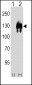 ENPP2 Antibody (Center)