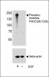 Phospho-HUMAN-PIK3C2B(Y228) Antibody