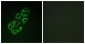 MtSSB Antibody