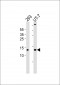 MtSSB Antibody