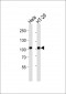 CDH17 Antibody