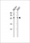 ARF6 Antibody