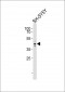 PSMC6 Antibody