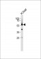 Cytochrome P450 27A1 Antibody