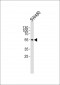 ZIC1/2/3 Antibody