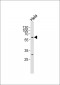 CPNE8 Antibody